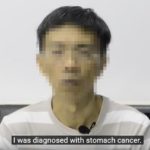 Stomach Cancer Case