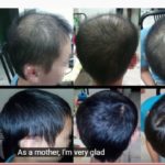 hair