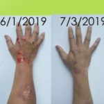 hand1